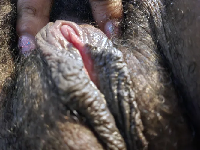 Peek a boo... 27 F T1D , BPD. MH Issues, Autism.