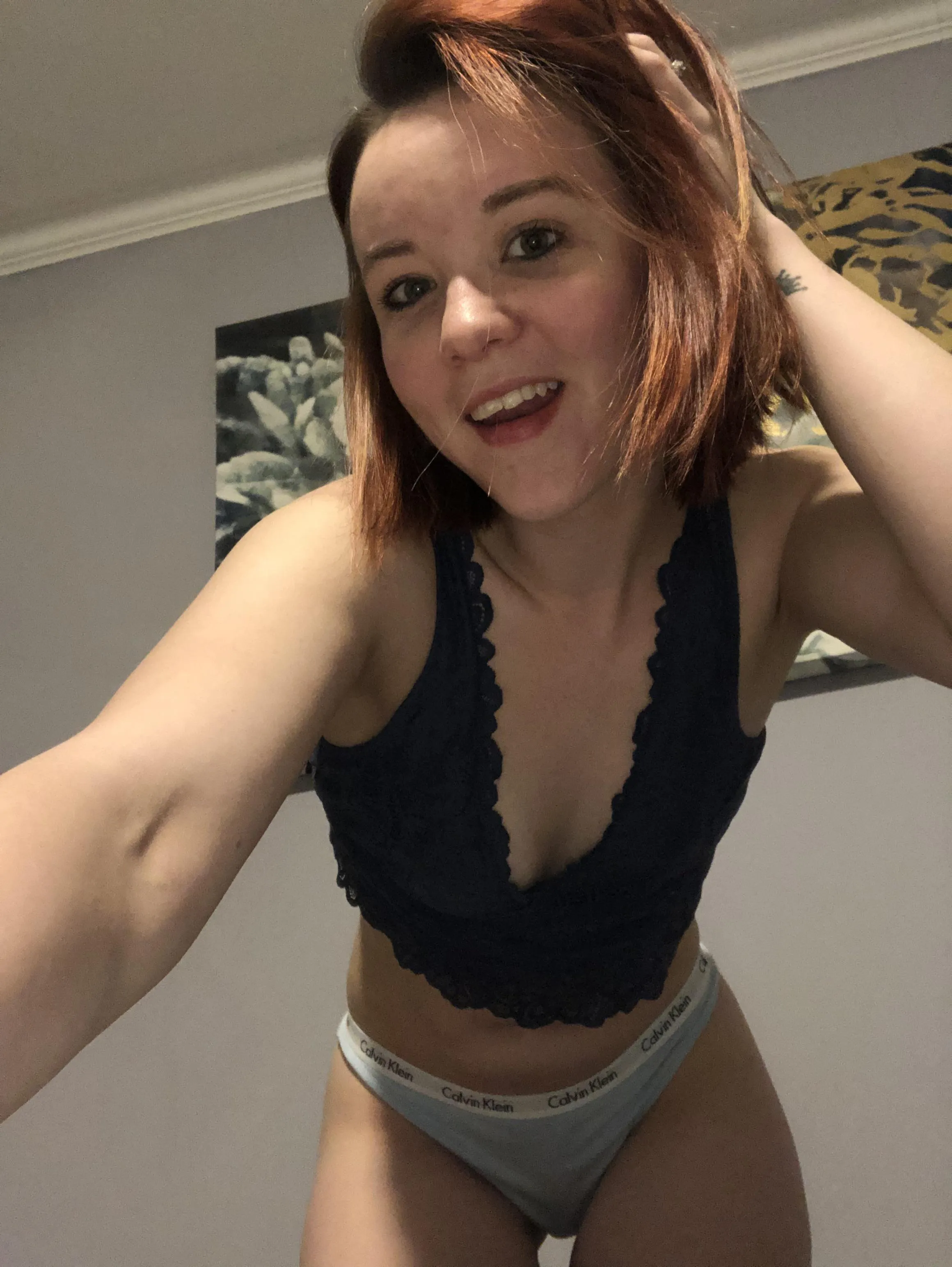 The freckle fire always burns strong