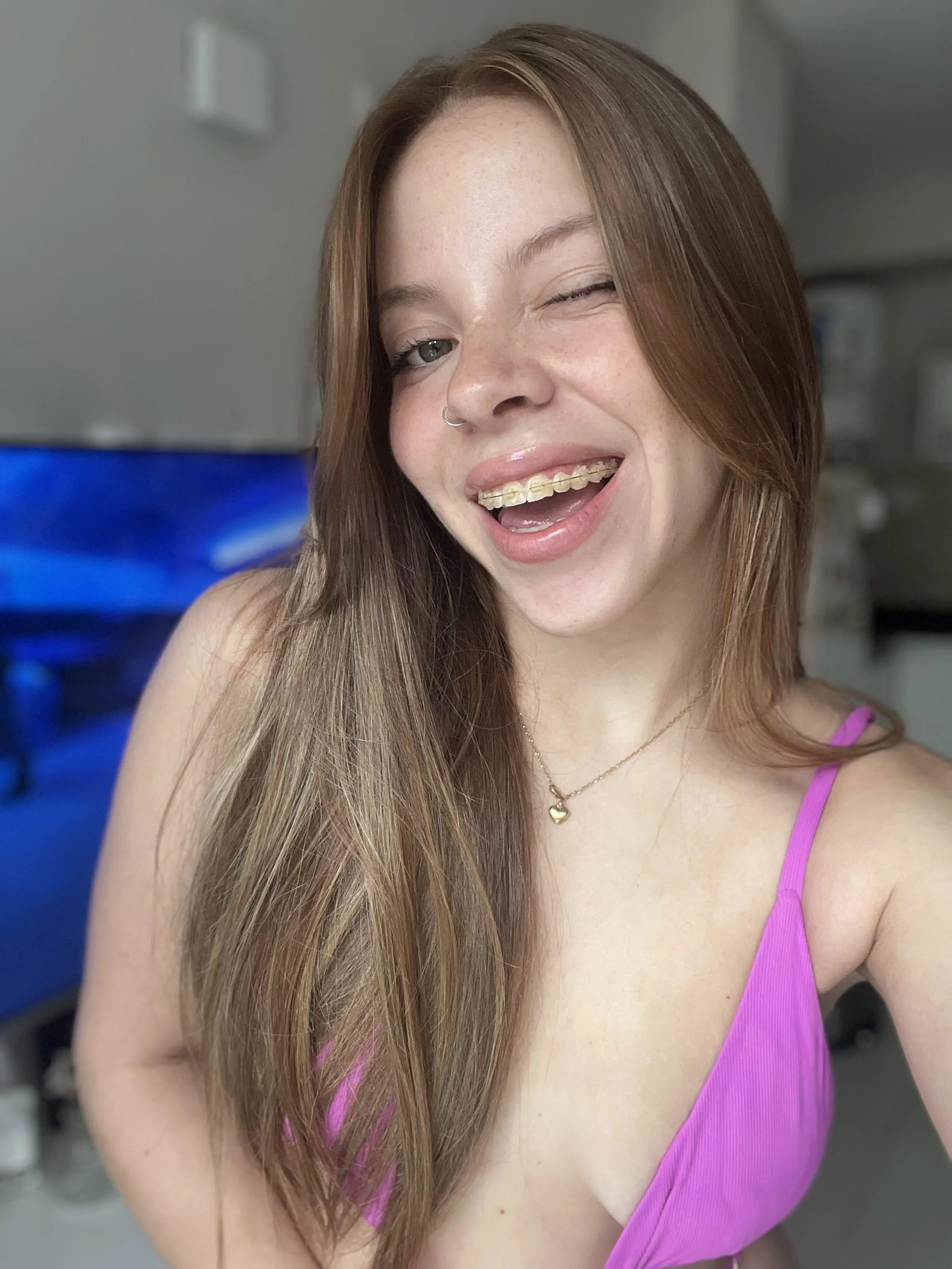 Here is your daily dose of my metal smile