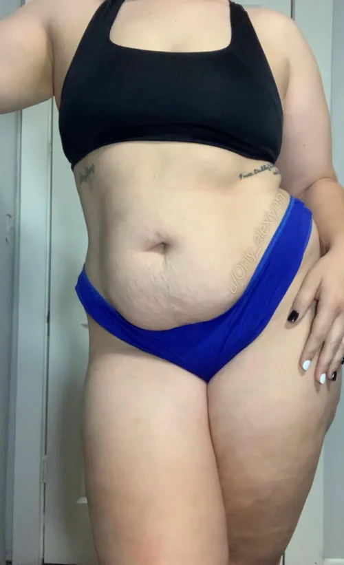 It deep & scarred but still cute