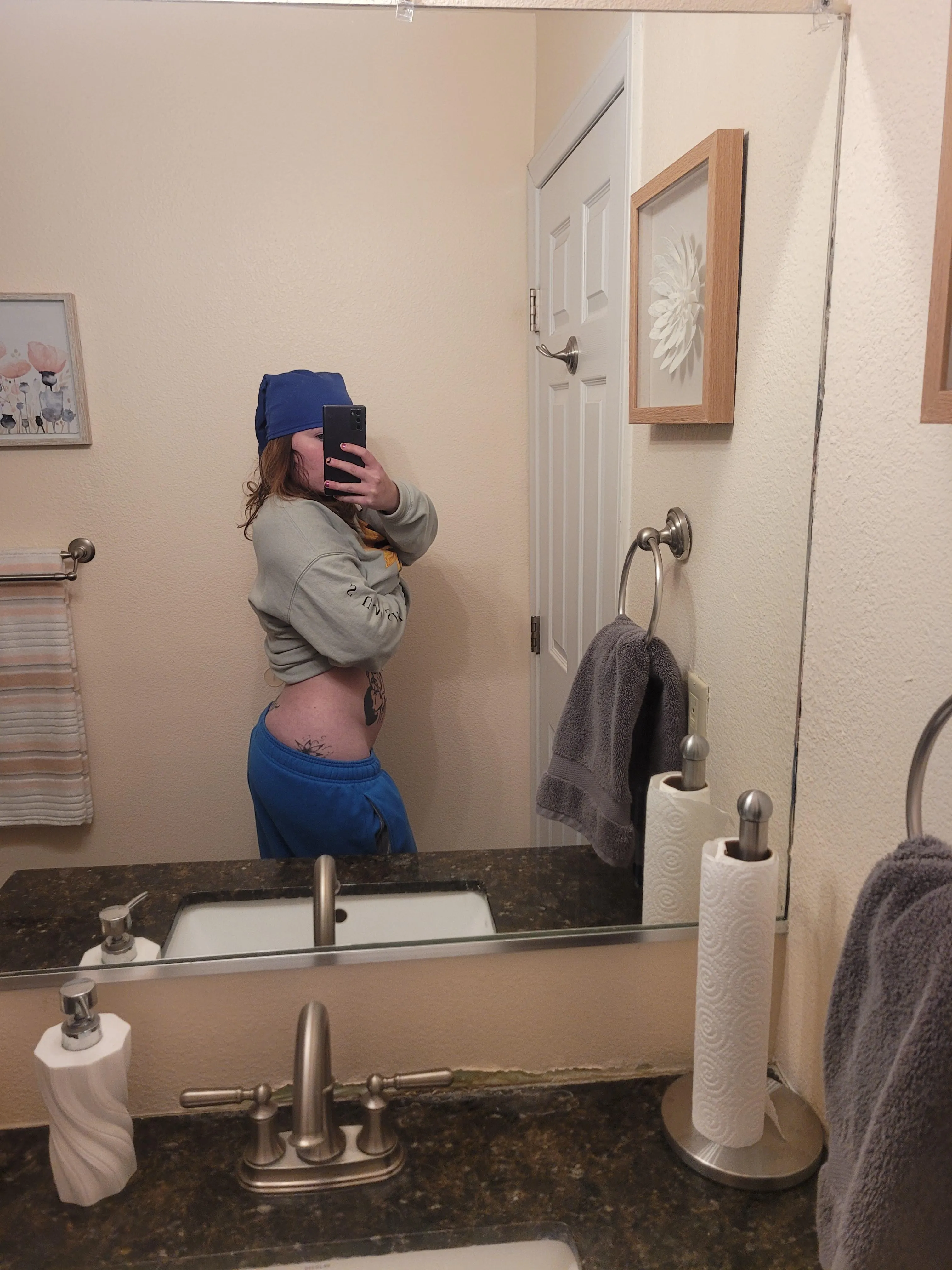 My booty is getting some white stretch marks