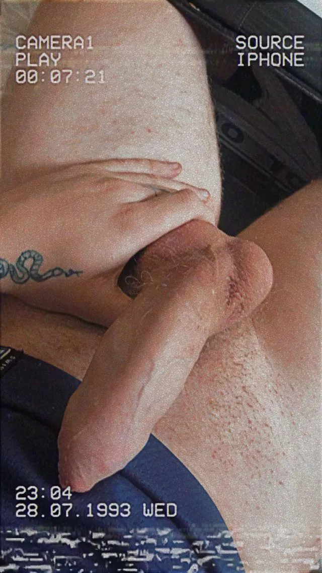 21m- autism, adhd and scoliosis. Im a little insecure and need some confidence- thoughts in uncut and girthy?