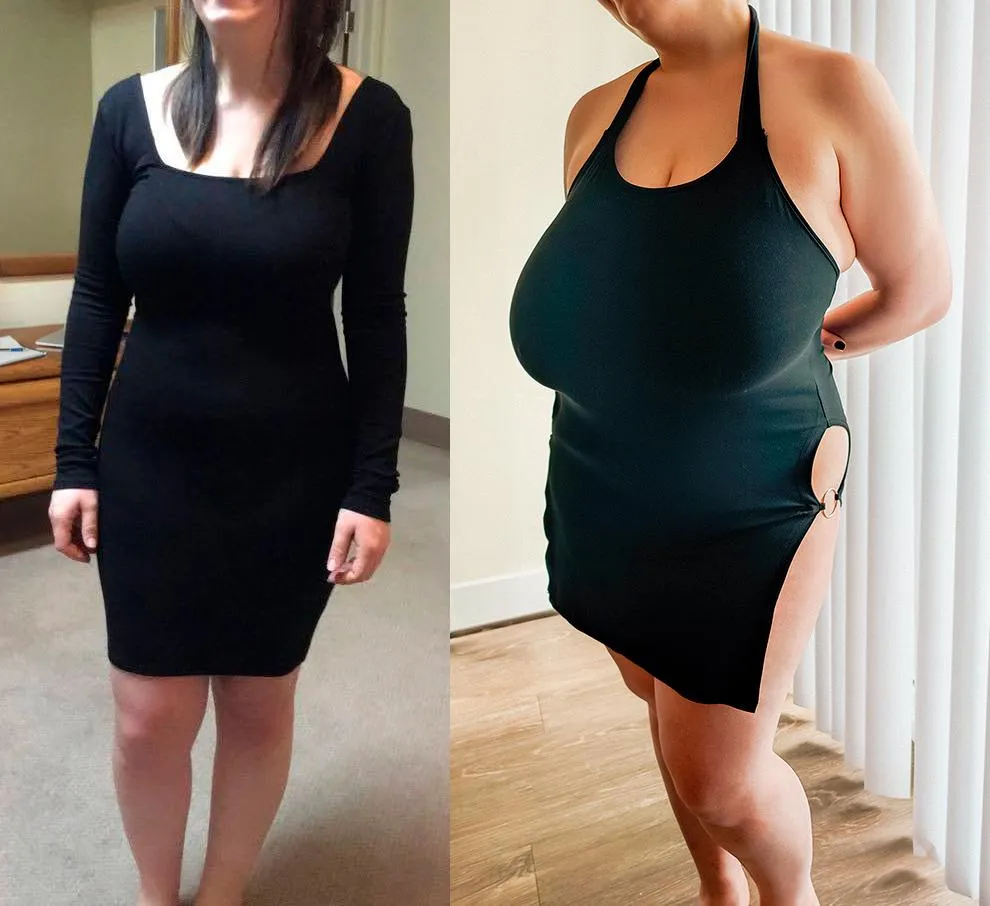 My real breast expansion