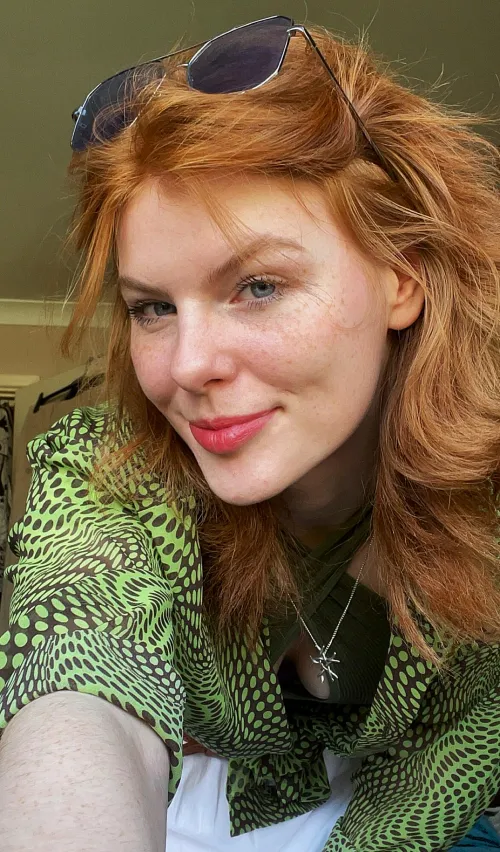 Living proof that freckles are just nature’s kisses[IRTR]