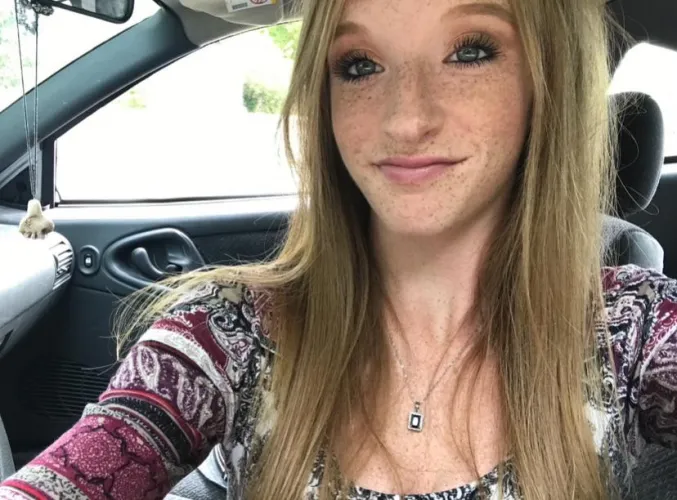 Freckles are popping today