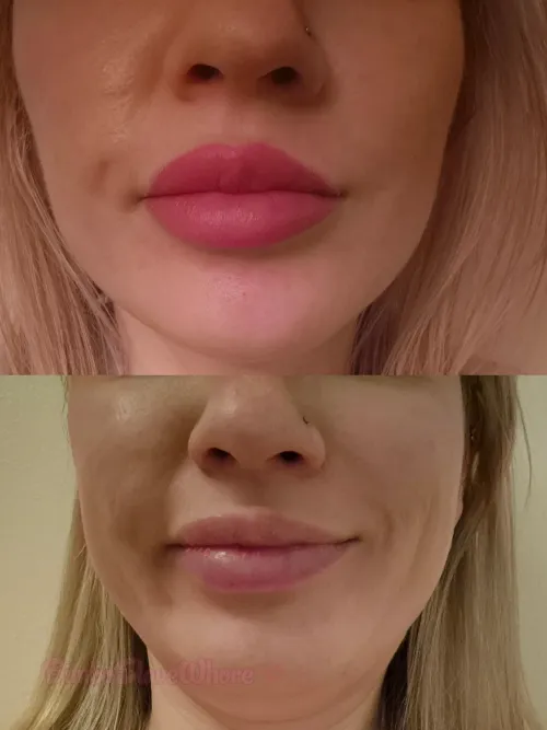 The Bimbofication continues. Lip blush. This is what they looked like this morning without any make up, and below, the before
