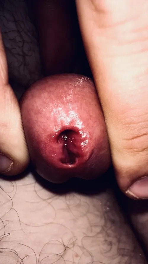 My gaping red pee hole