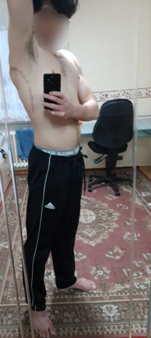 Do you also have names for your scars?