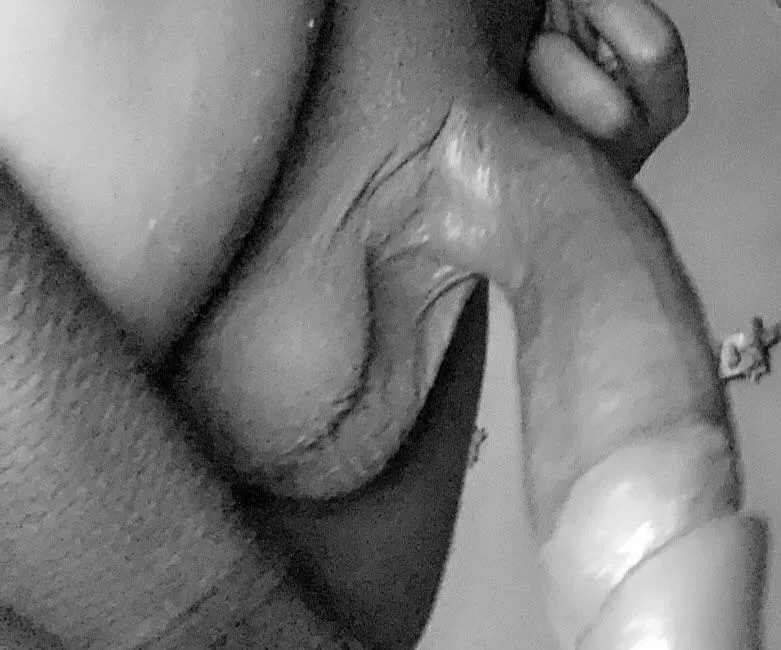 (Age: 27) It needs a hole to fill