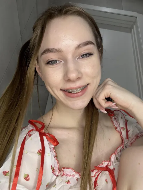 A smiling baby face with braces