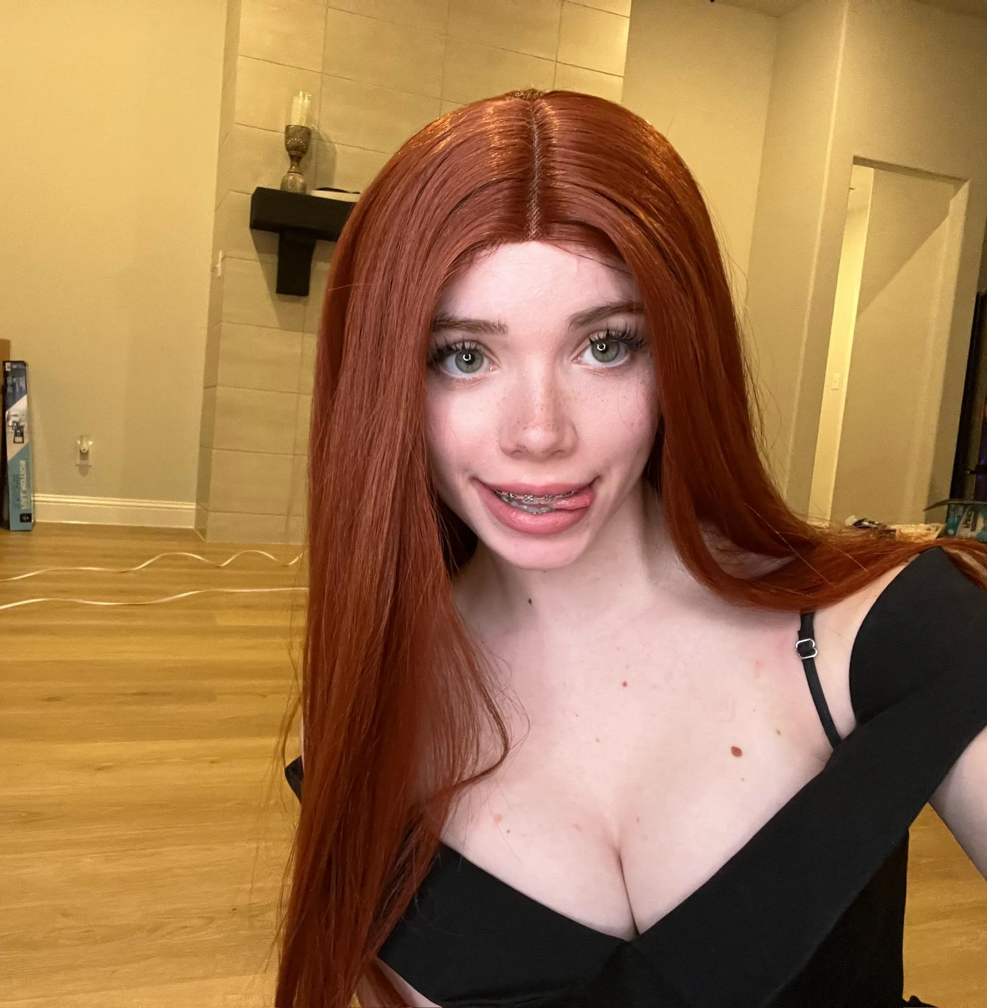 braces update! what color should I pick next >//<