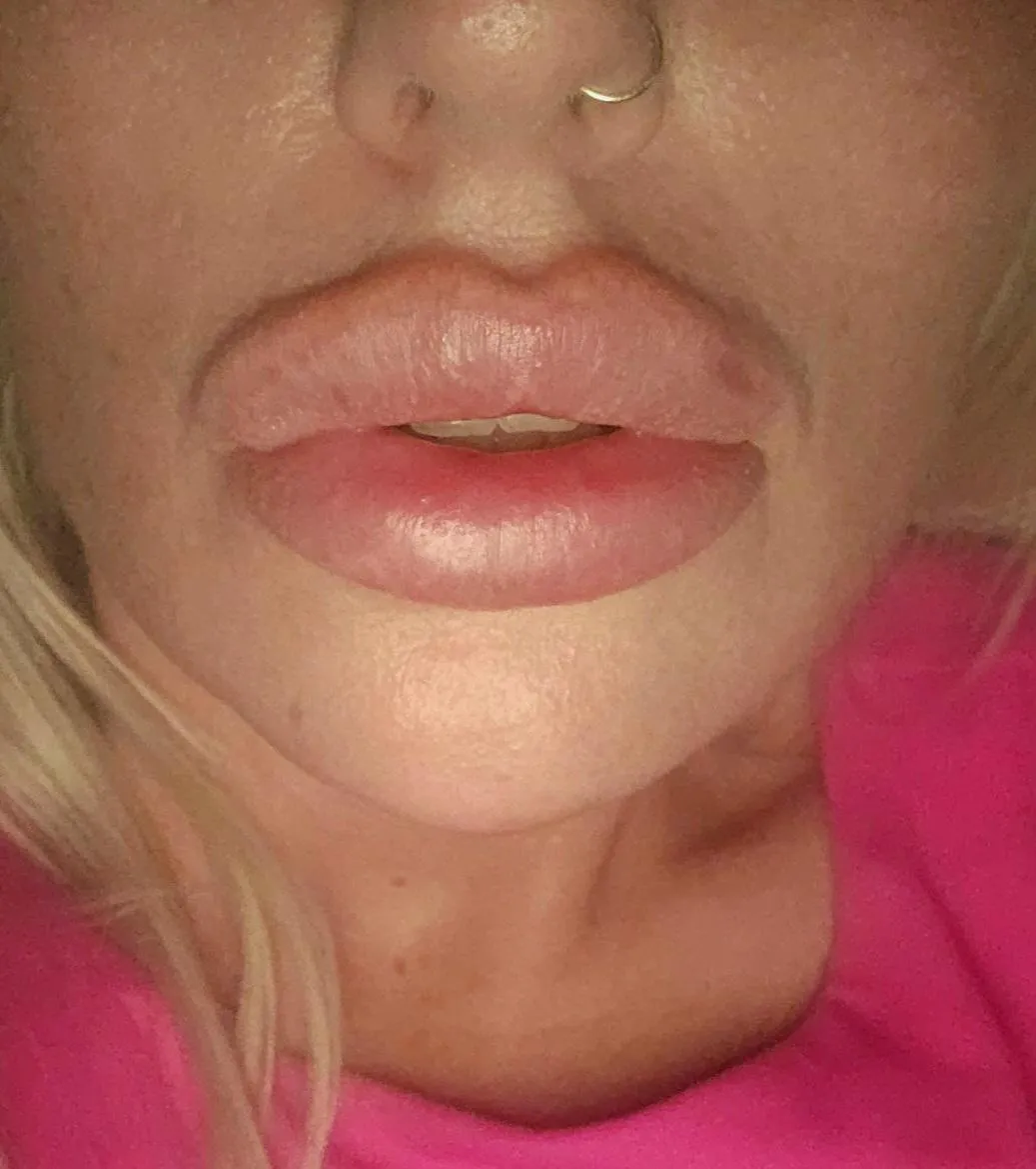 Resting cockhole and upper lip shelf with my newest fill up