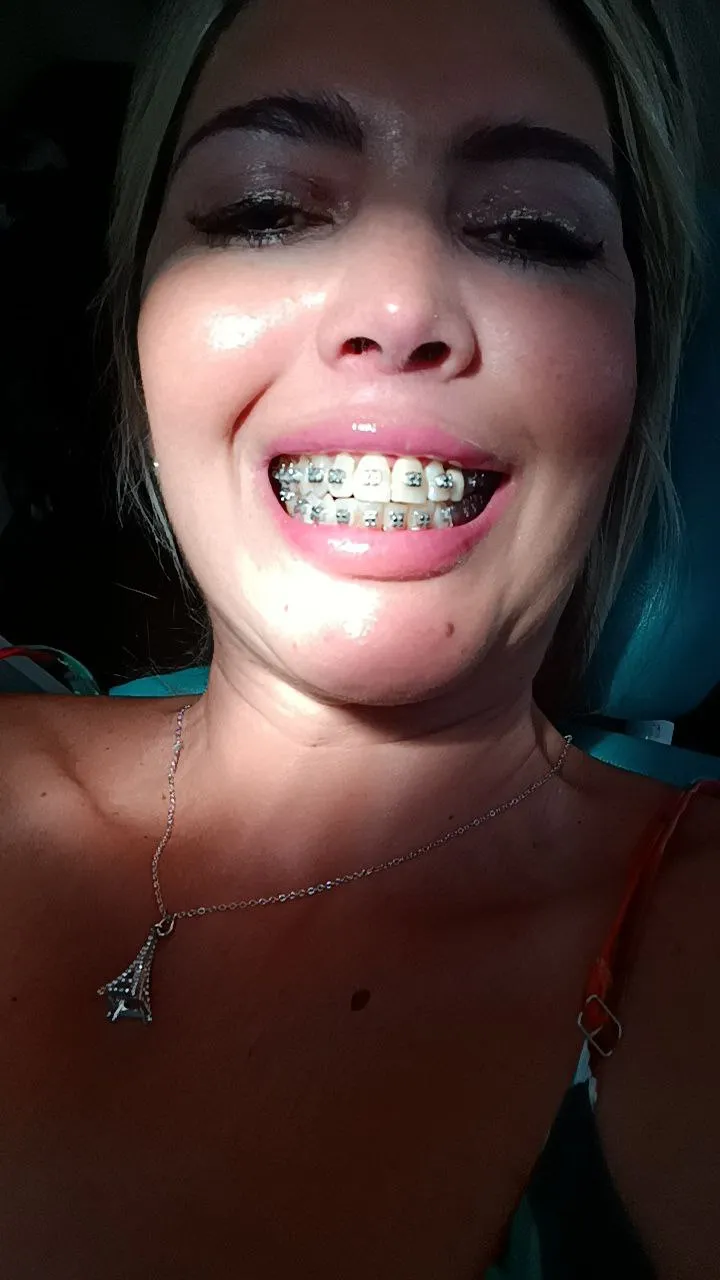 Rub your dick against my metal mouth