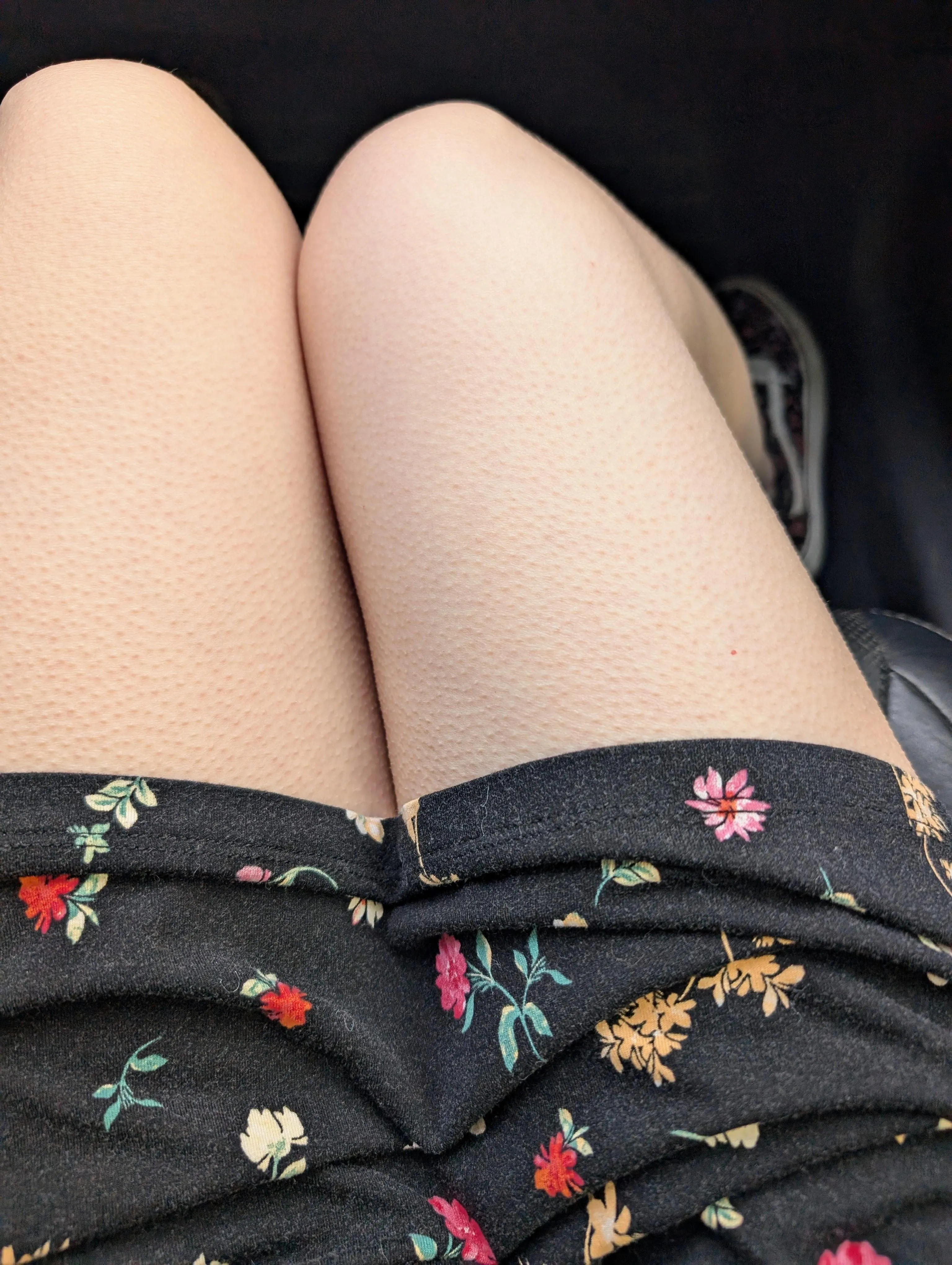 Goosebumps every time my favorite songs come on