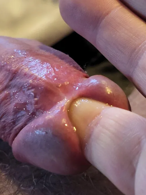 I love a finger in my urethra