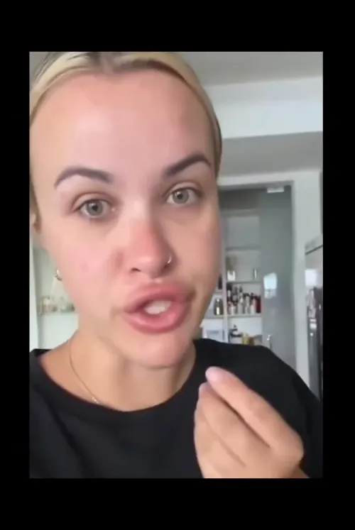 I hope she doesn’t go back to the same lip filler person