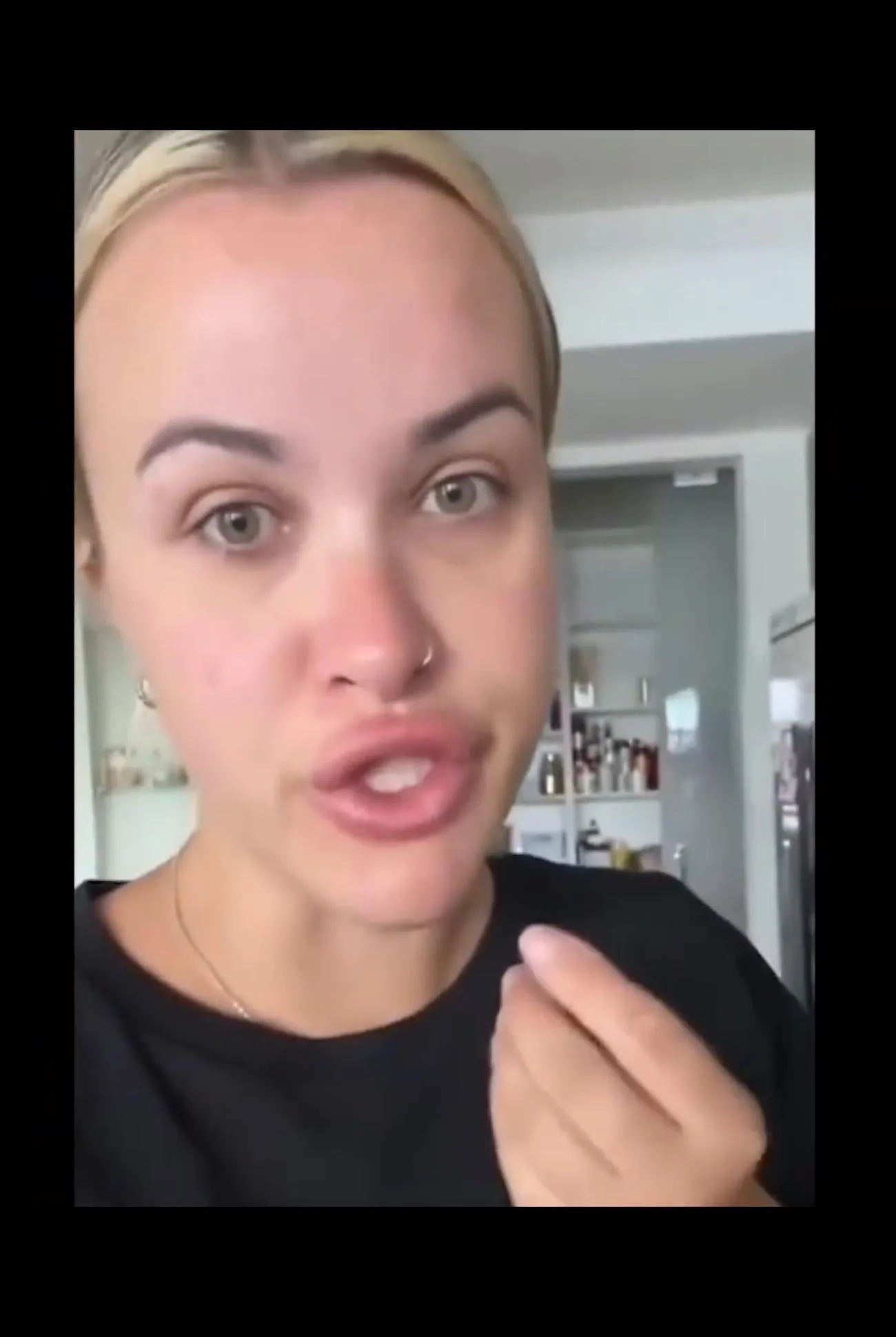 I hope she doesn’t go back to the same lip filler person