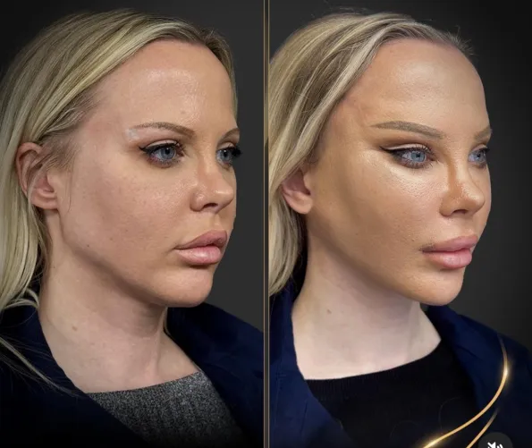 I’m assuming this is the result she wanted but…yeah it’s bad.