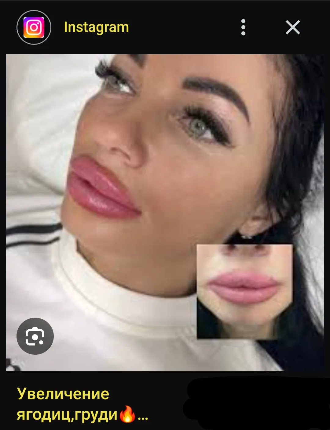 Least botched lips (found in the wild).