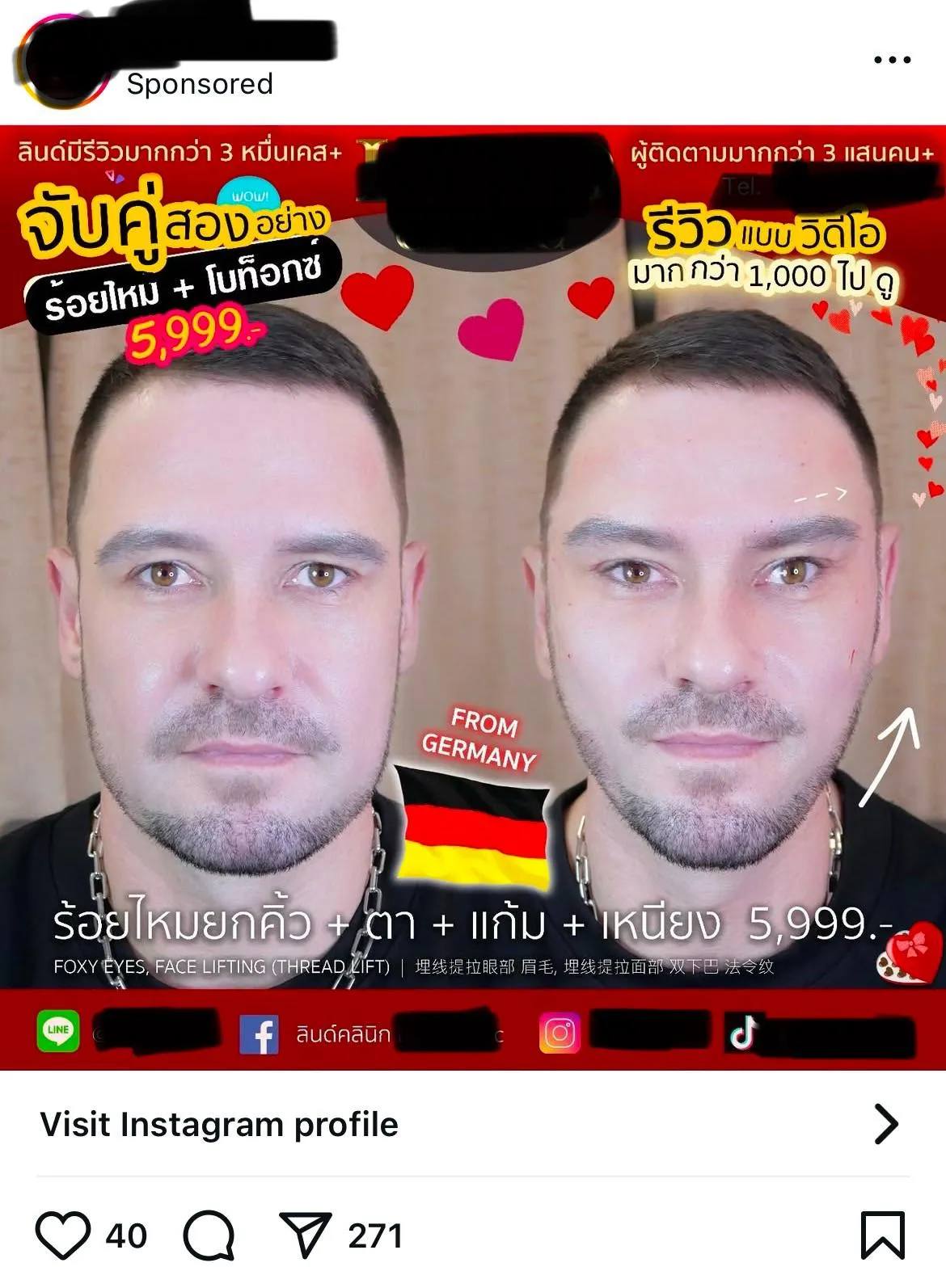 Look what they did to him 😟