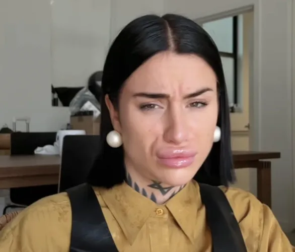 Skip your next filler appointment hun