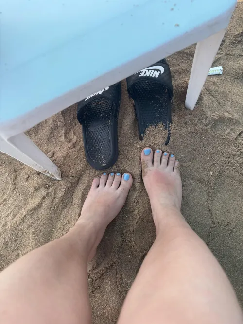 My foot was stung by jellyfish, should someone pee on it?