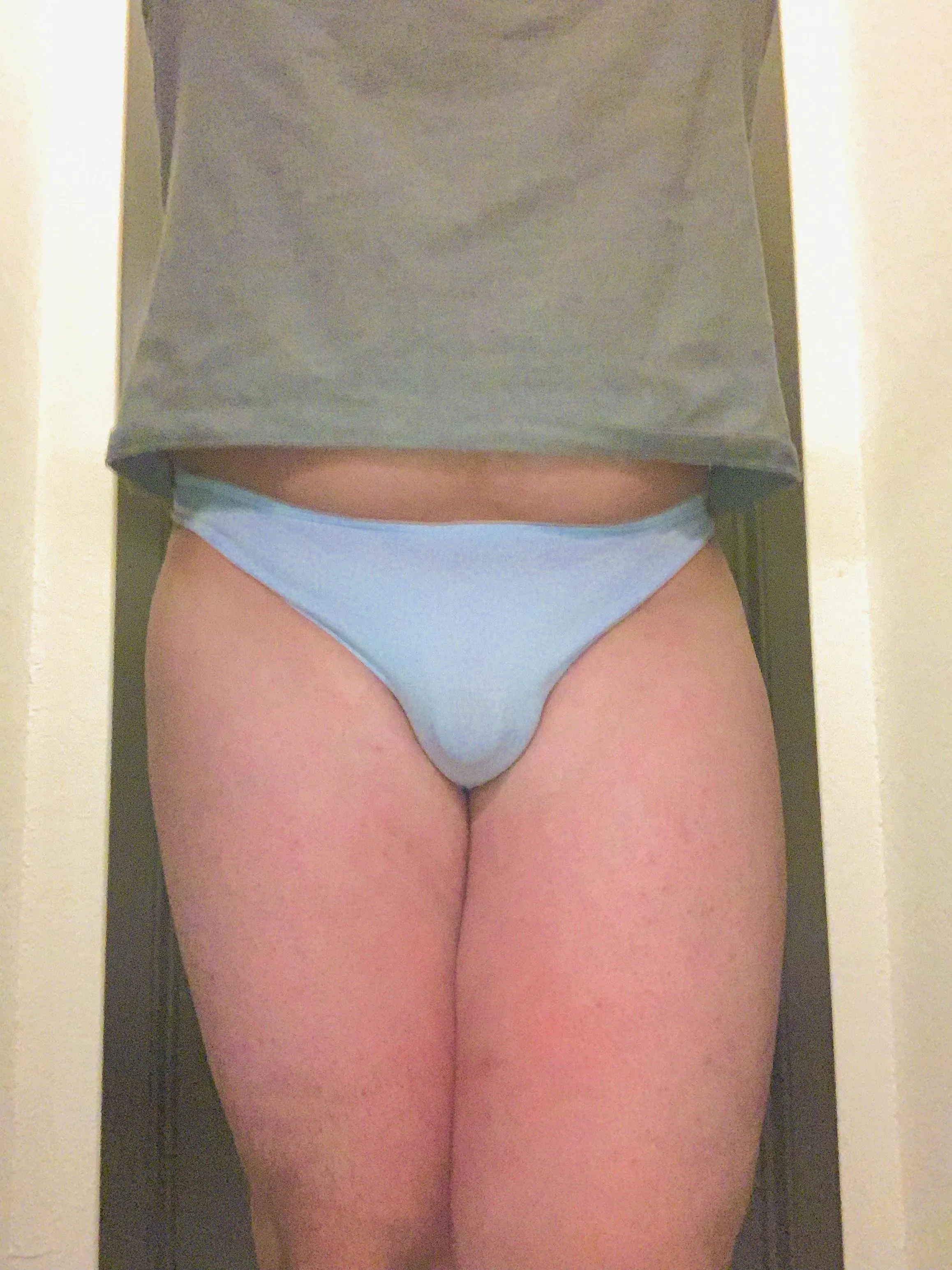 Should definitely be exposed