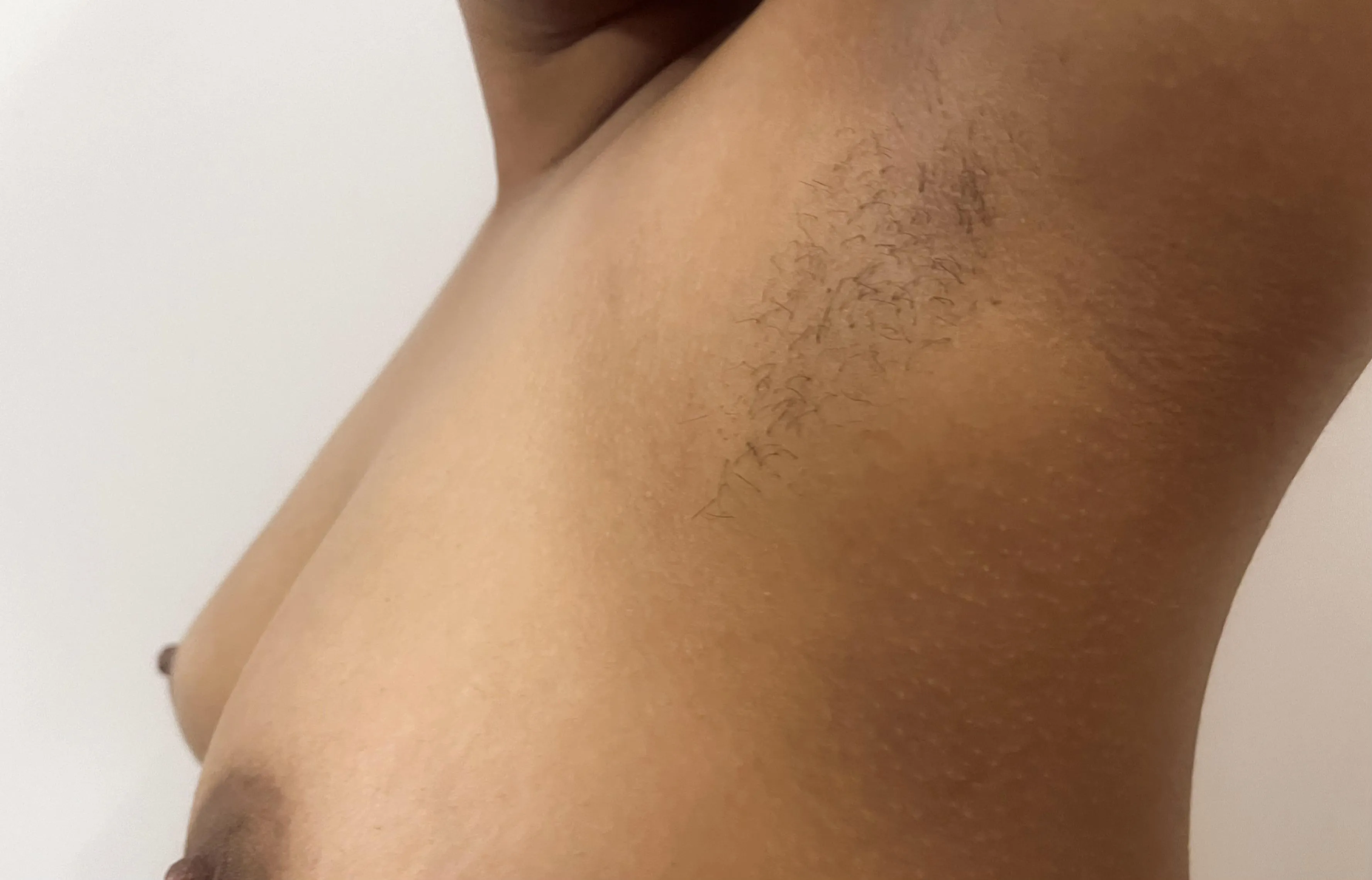 (C) The armpit continues.