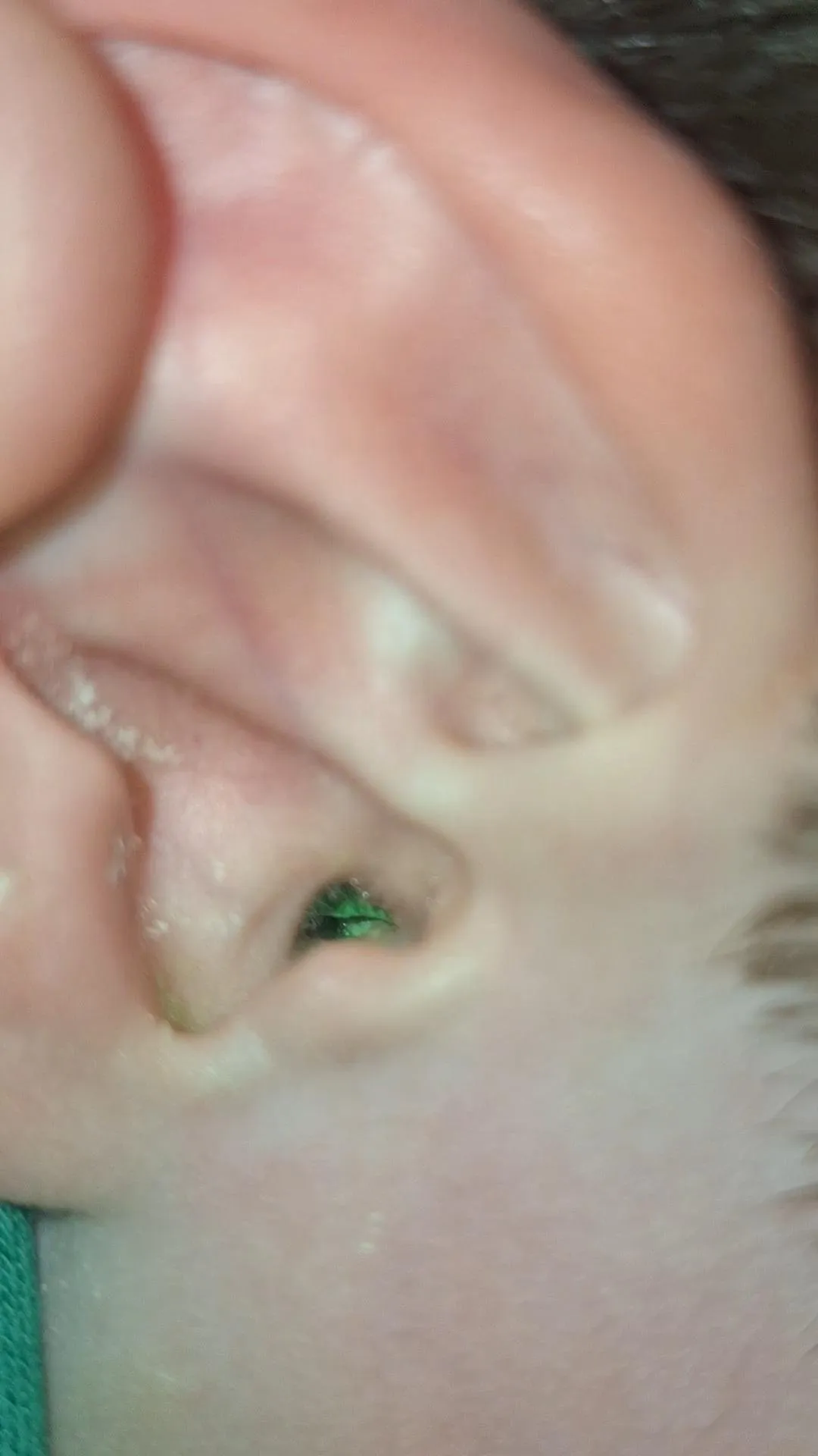 My 4 year old had lot pain in his ear on Tuesday, we brought him to doctors on Tuesday and got antibiotics and oral drops. Doc made note saying bad infection with green pus in right ear... we started medication and he''s doing lot better already and no