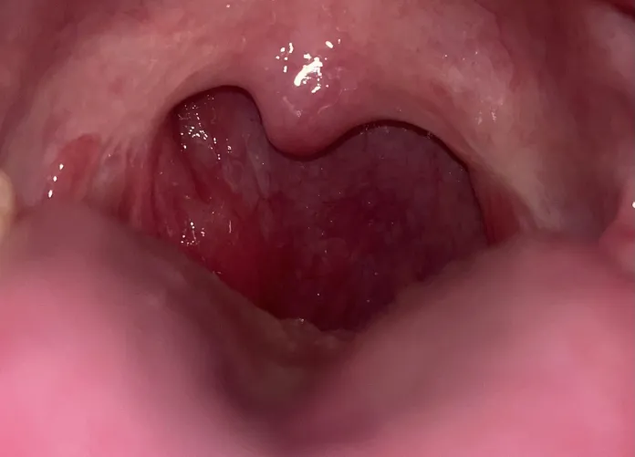 Regular sore throat I can treat with self care or should I have it examined by a doctor?