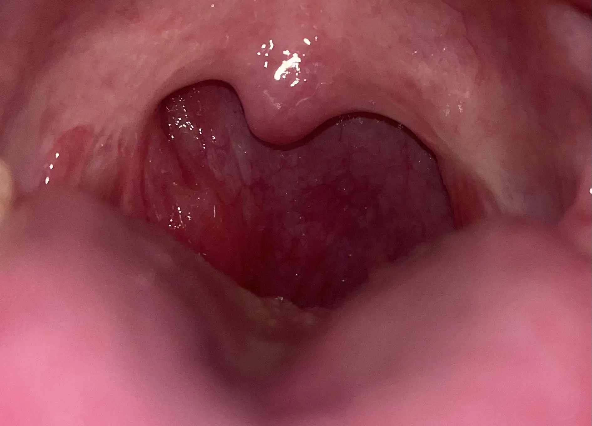 Regular sore throat I can treat with self care or should I have it examined by a doctor?