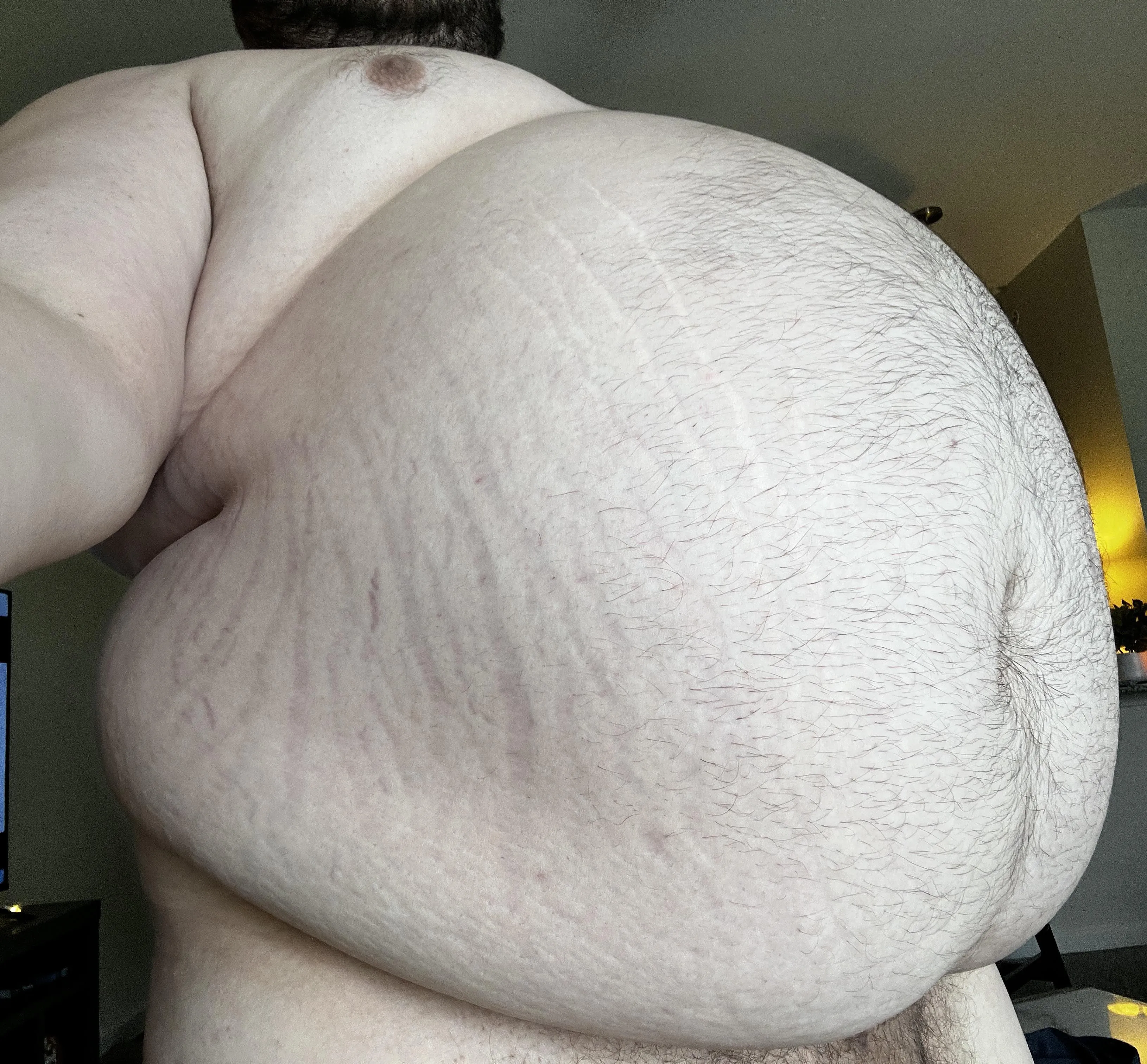 Making these stretch marks pop again