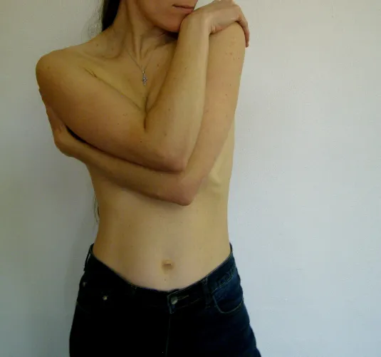 Shy armbra