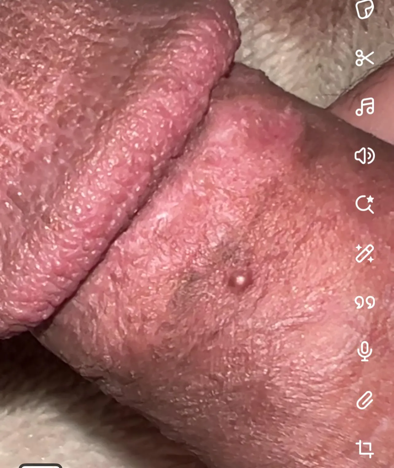 What can this be ? And how do I get rid of it thanks