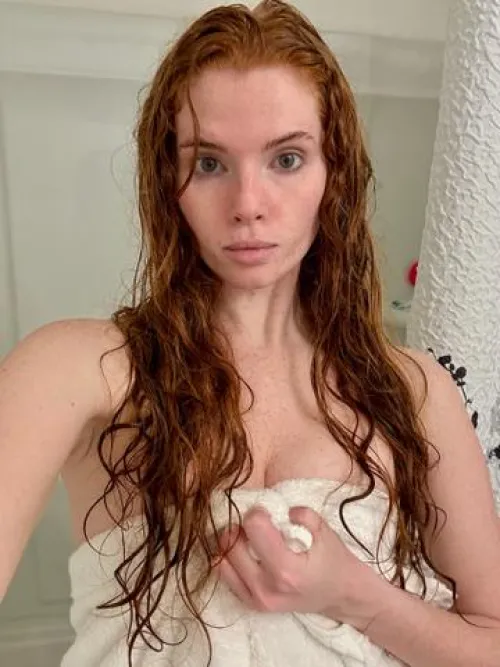 [IRTR] my freckles are out after my shower