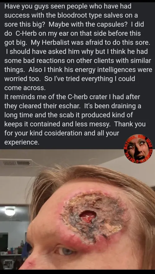 The result of using too much black sale on your forehead.