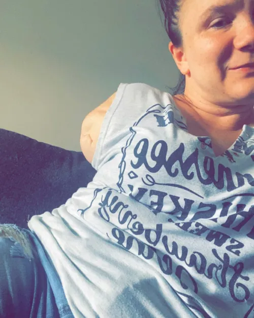 One of my two above the elbow stubs! Kink and dev friendly :p