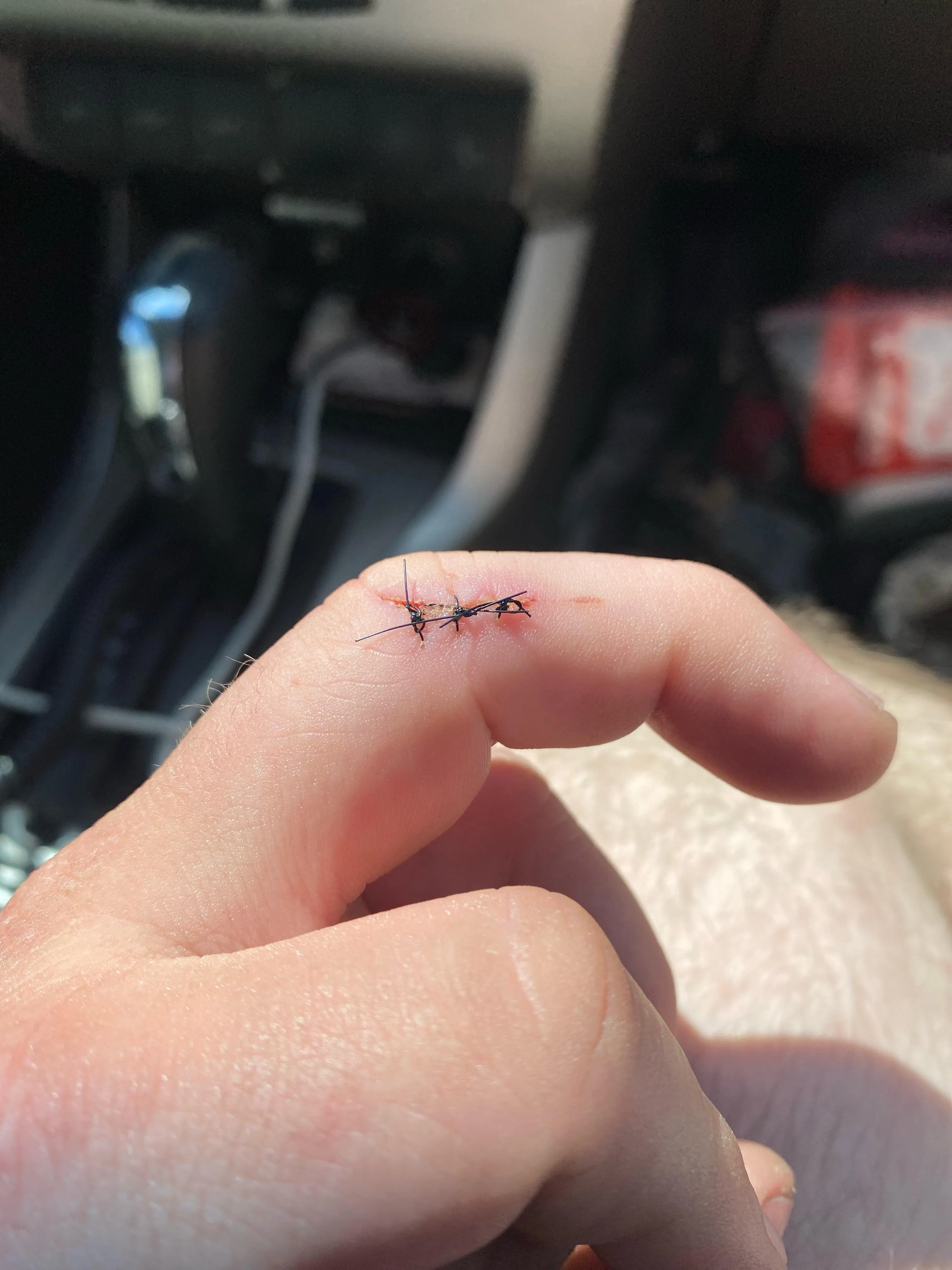 Are my stitches healing ok/ready to come out soon? I just want to make sure I don’t get a nasty infection