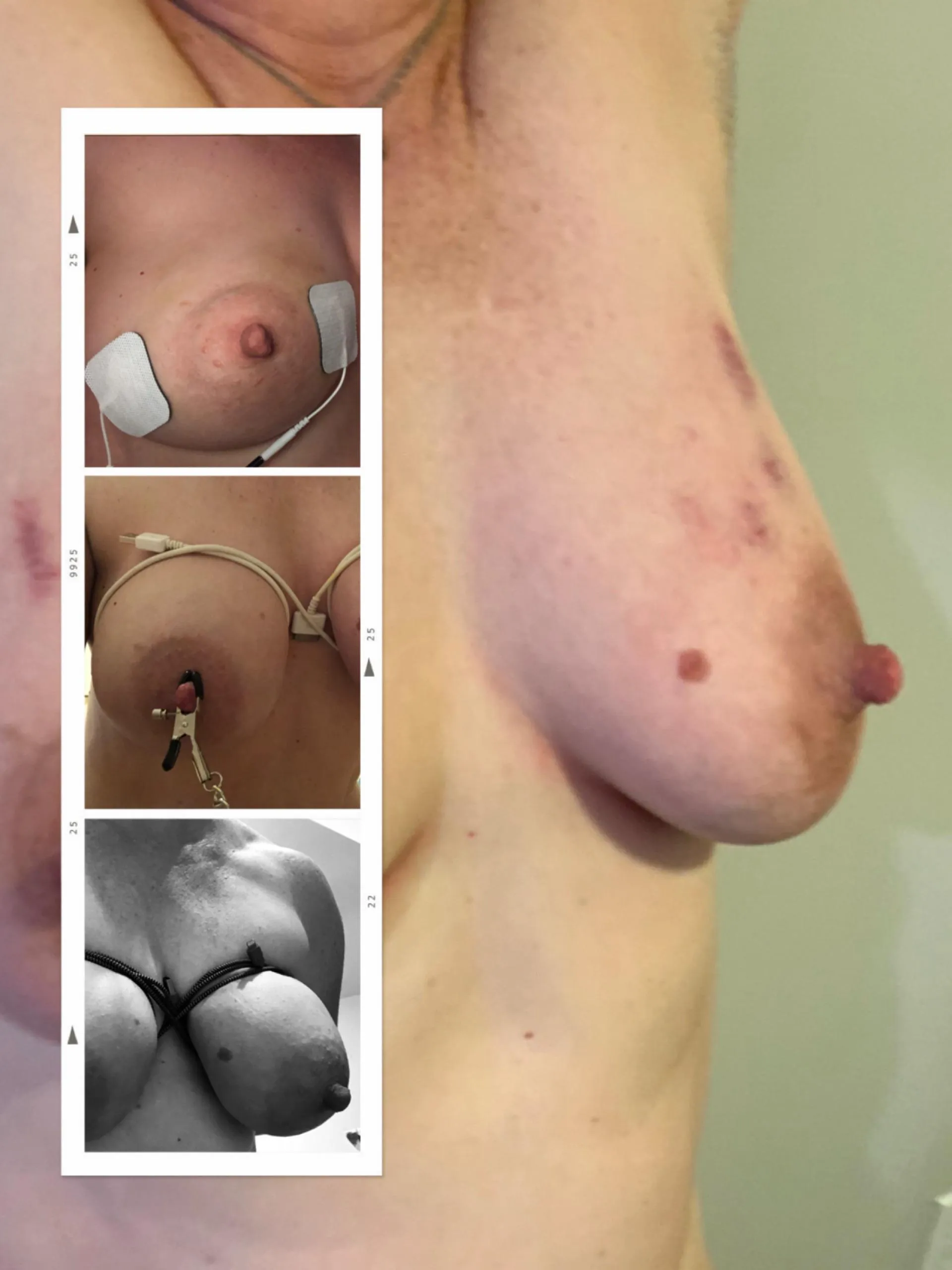 Cables, cords, electricity, and hickies