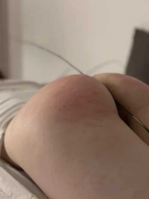 last night I got hit 30 times with a twig 🥰