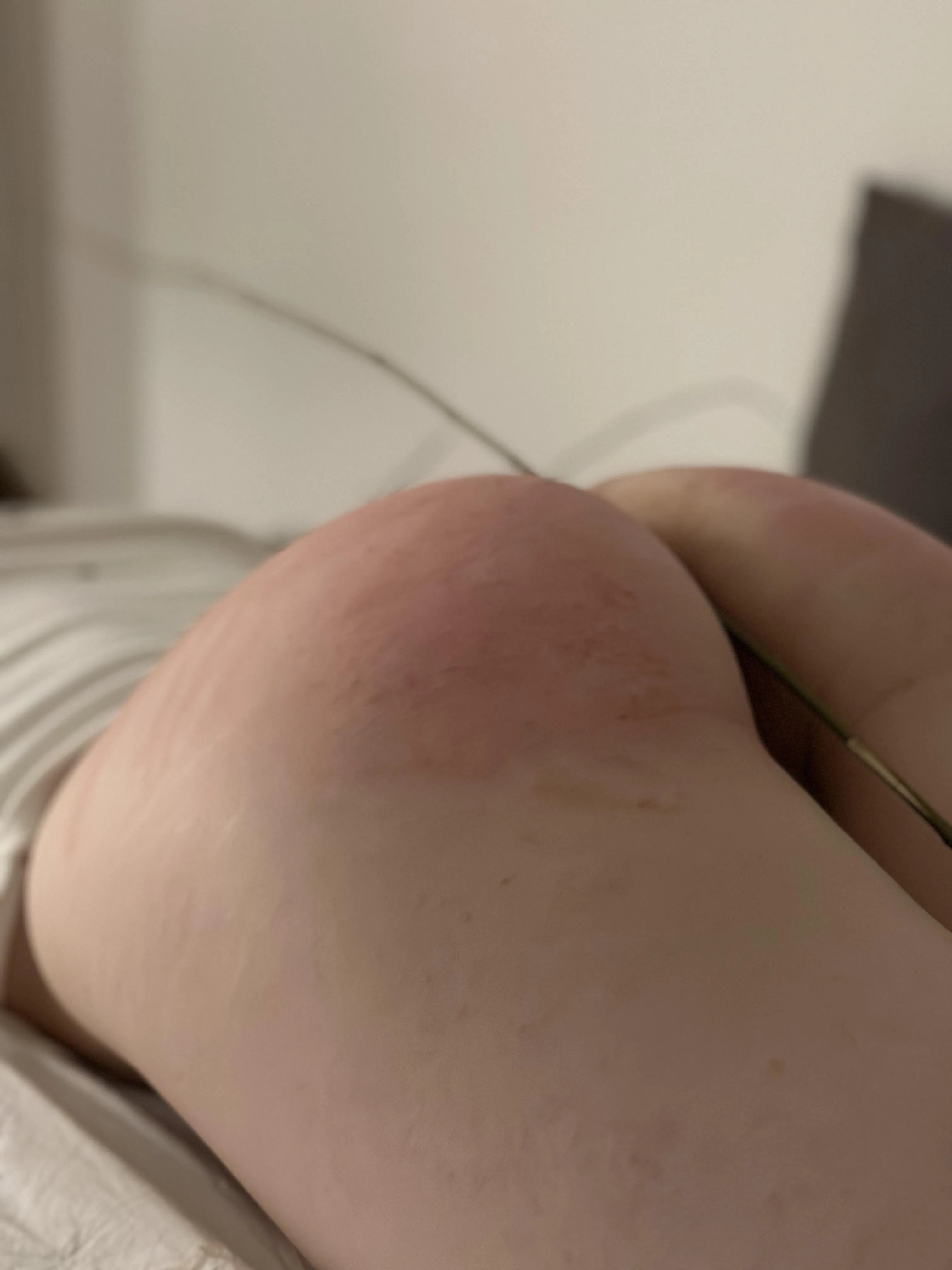 last night I got hit 30 times with a twig 🥰