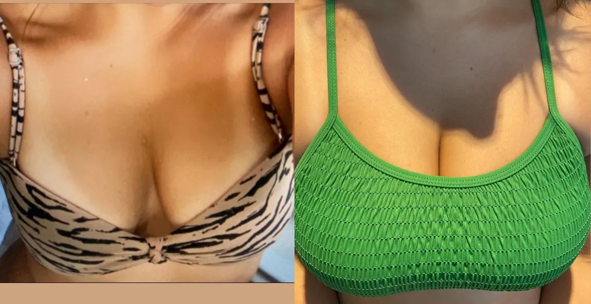 She has 2 freckles I always try and line up to highlight how huge her boobs have gotten over the years