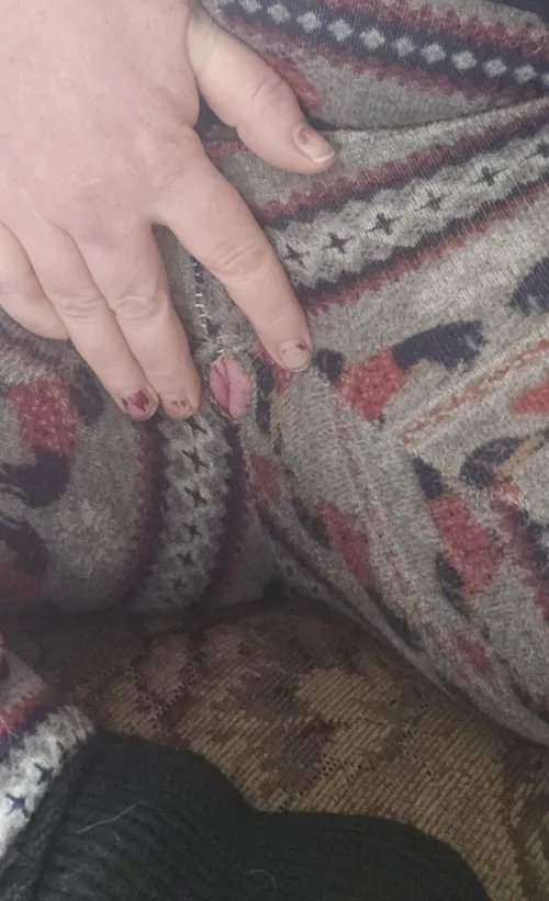 There's a hole in my pants 🫣