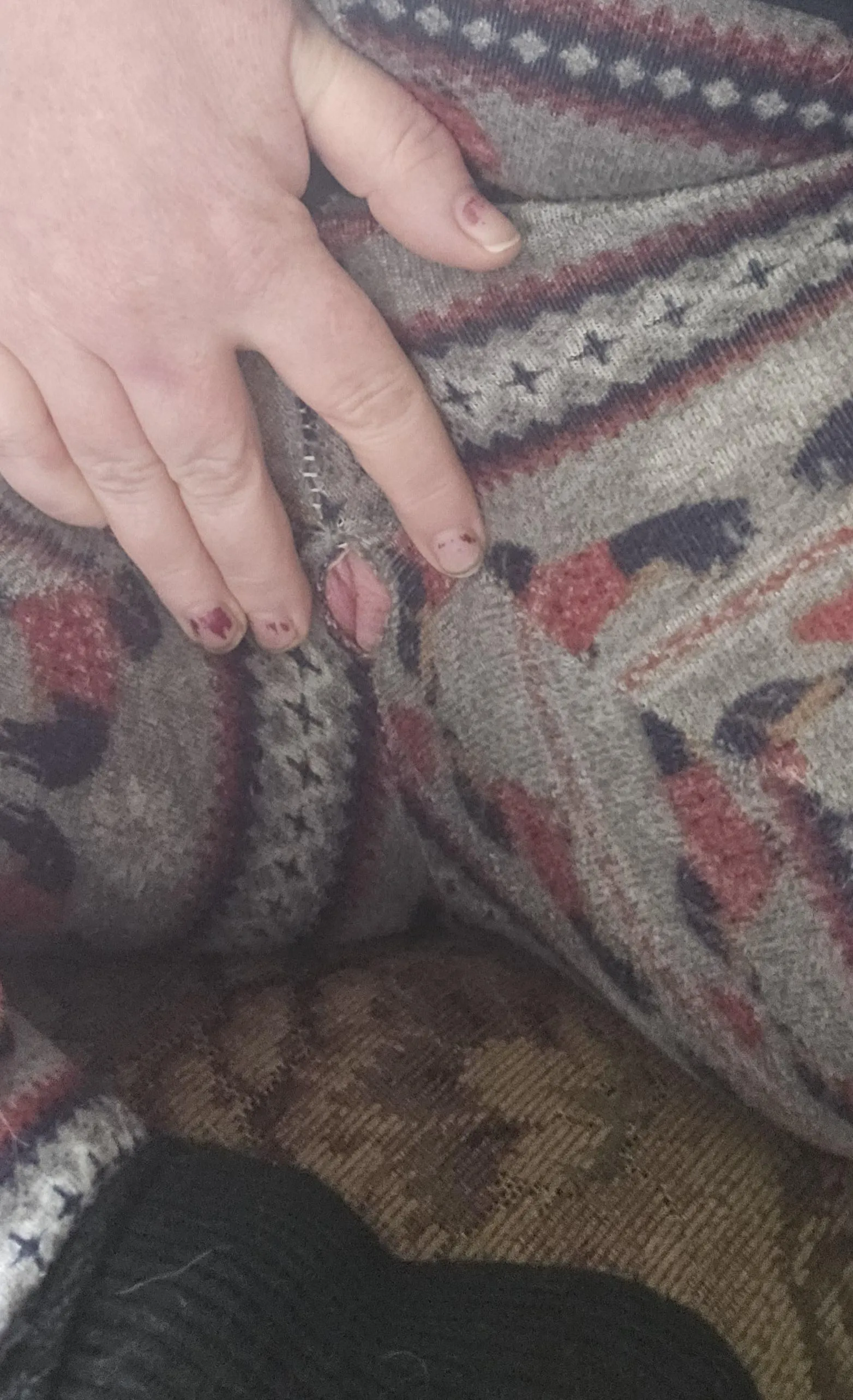 There's a hole in my pants 🫣