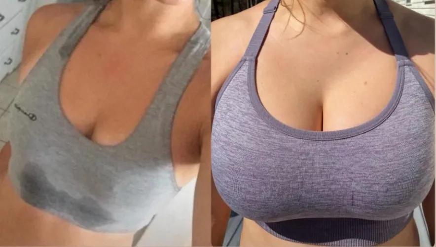 My wife went from a 34B when we first met to a 34DDD at her biggest