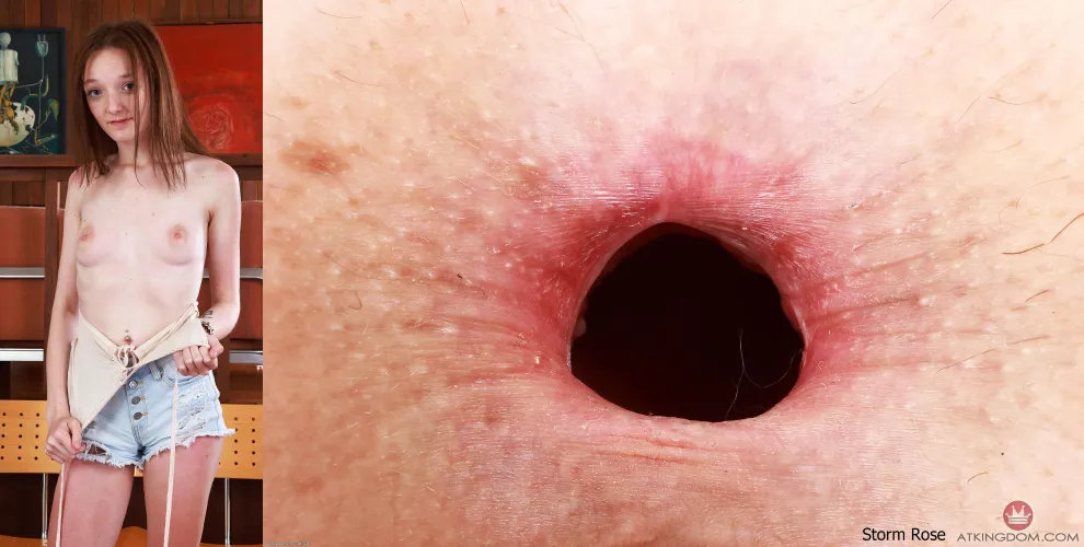 Storm Rose's Asshole