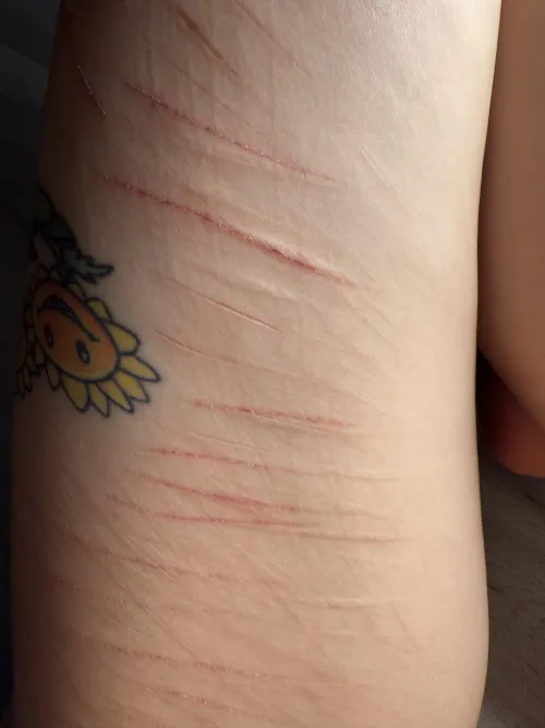 Pretty little lines 💗