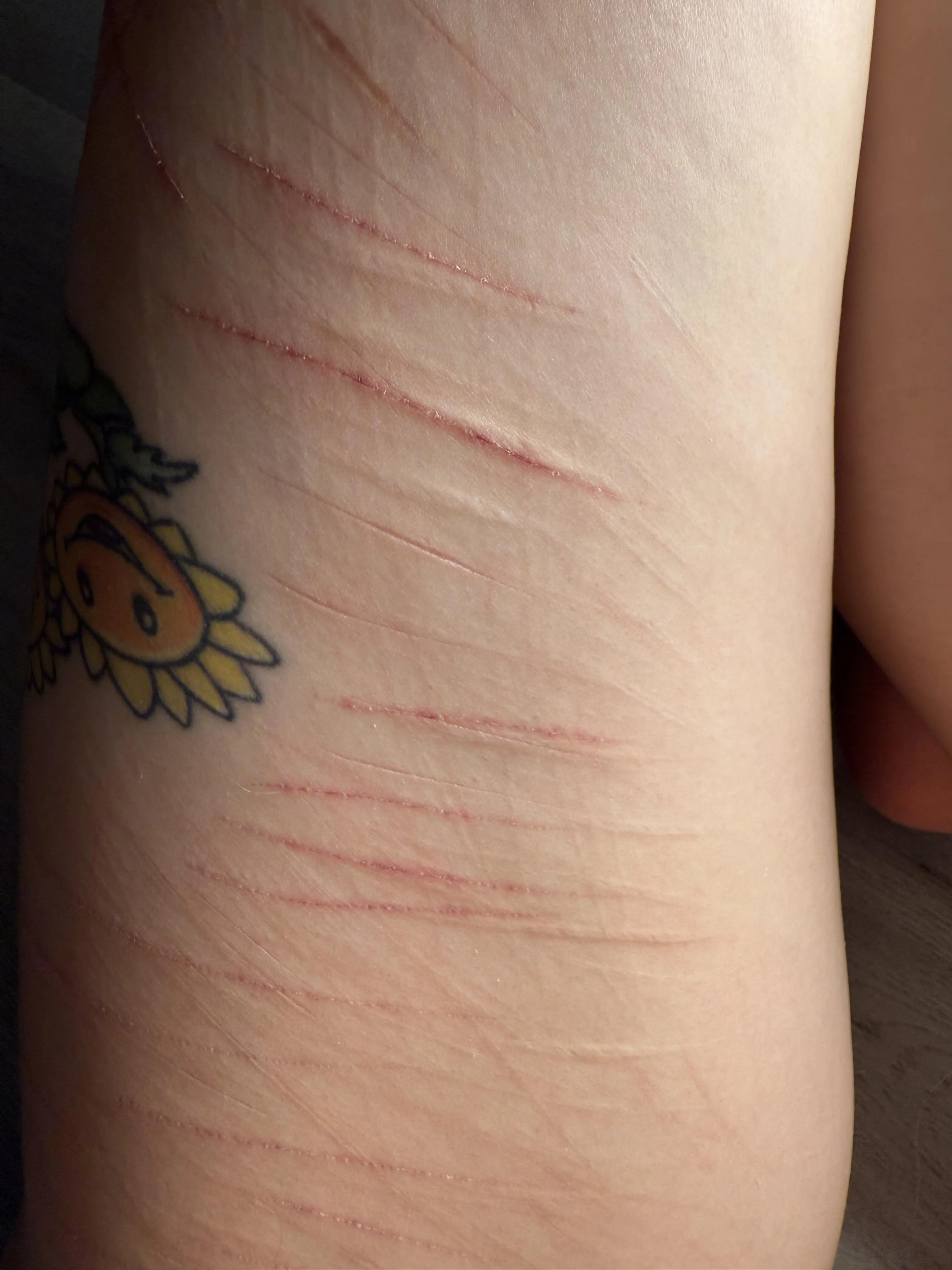 Pretty little lines 💗