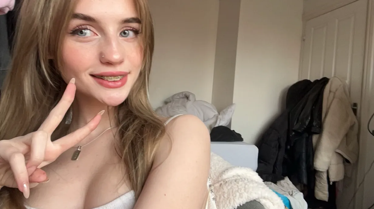 do braces on girls turn you on?