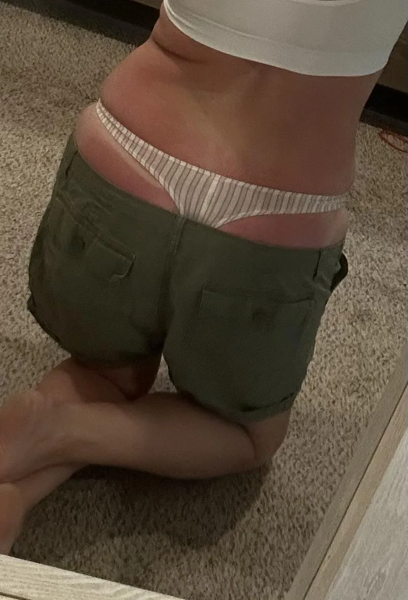This sunburn needs to heal.